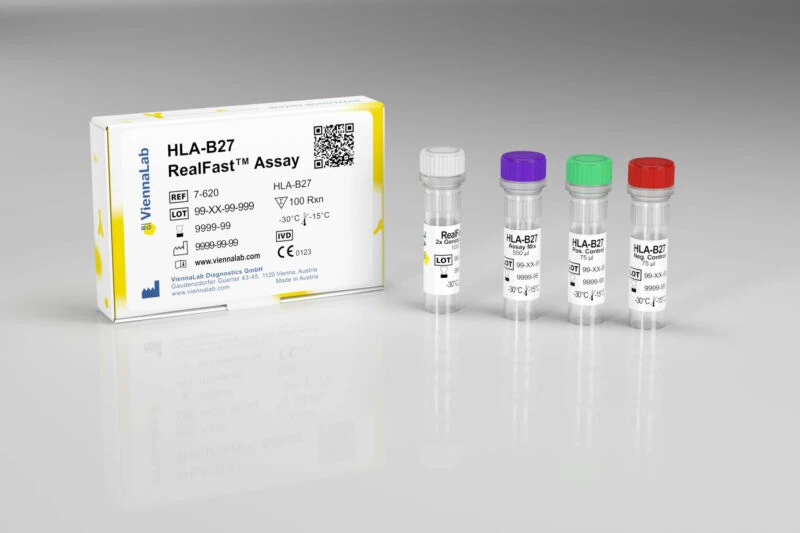 HLA-B27 PCR Assay