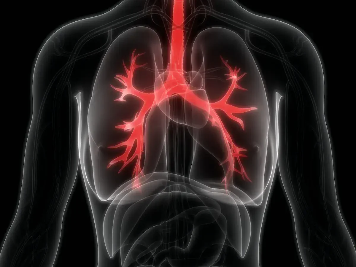 Cystic Fibrosis: Understanding the Genetics, Diagnosis, and Importance of Early Detection