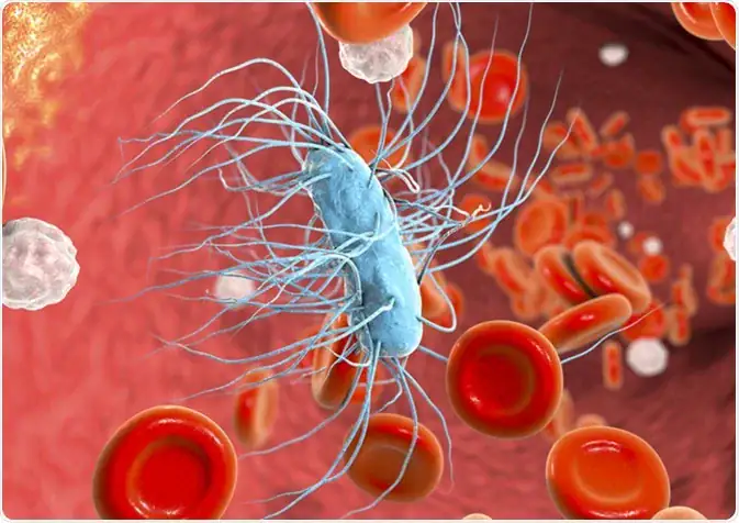 Leading the Charge against Sepsis: Goffin Molecular Technologies at the Frontline